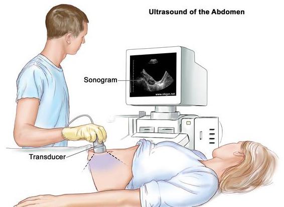 трансабдоминални узи је
